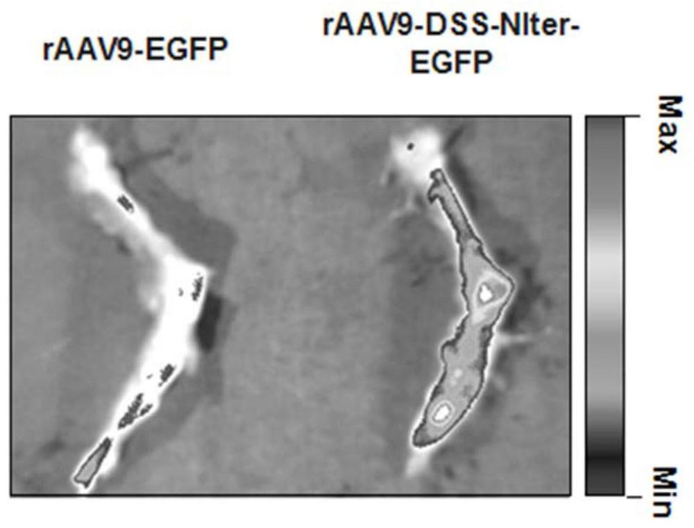 Recombinant plasmid for inhibiting SOST gene expression, bone-targeted recombinant adeno-associated virus thereof and application of bone-targeted recombinant adeno-associated virus