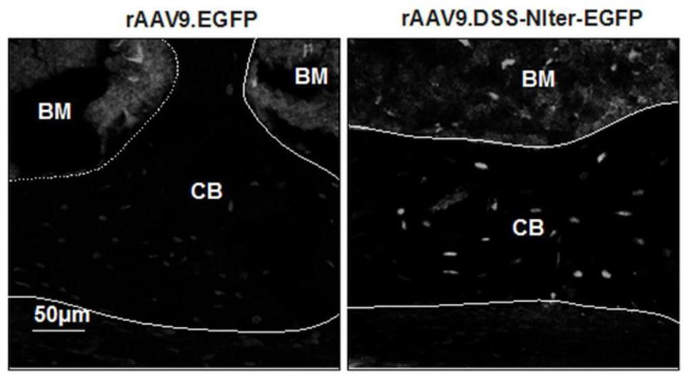 Recombinant plasmid for inhibiting SOST gene expression, bone-targeted recombinant adeno-associated virus thereof and application of bone-targeted recombinant adeno-associated virus