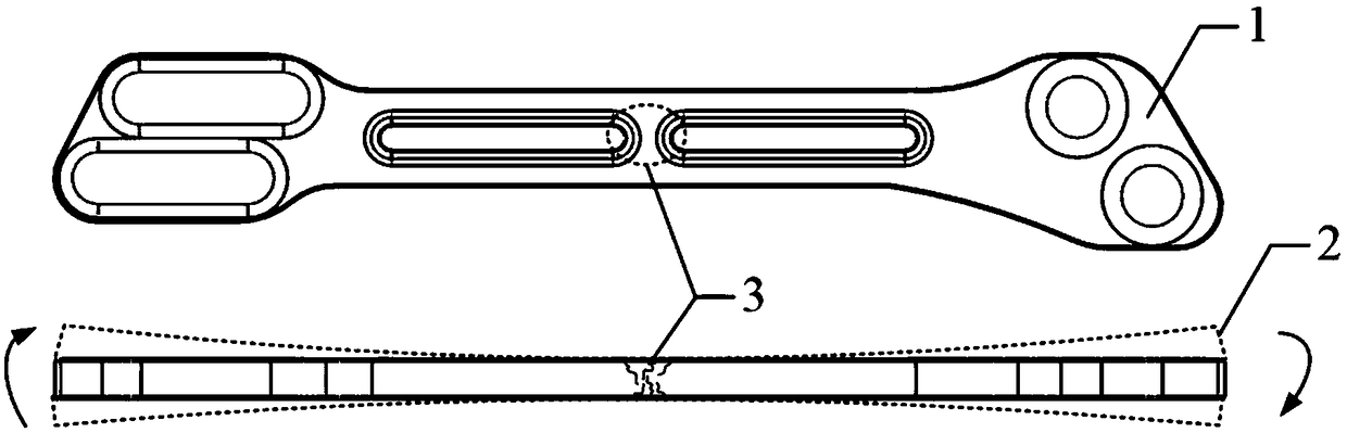 Method for processing lightweight orthopedic stent