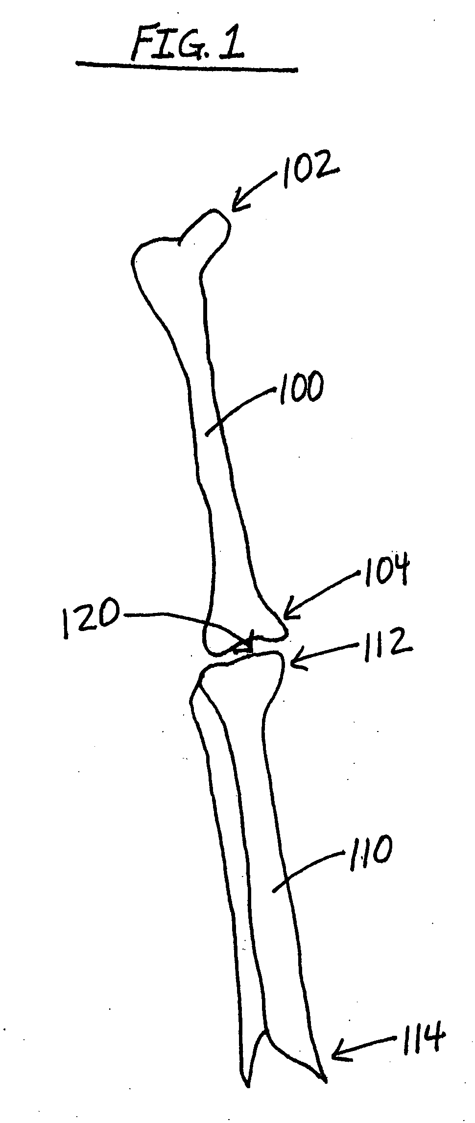 Arthroplasty devices and related methods