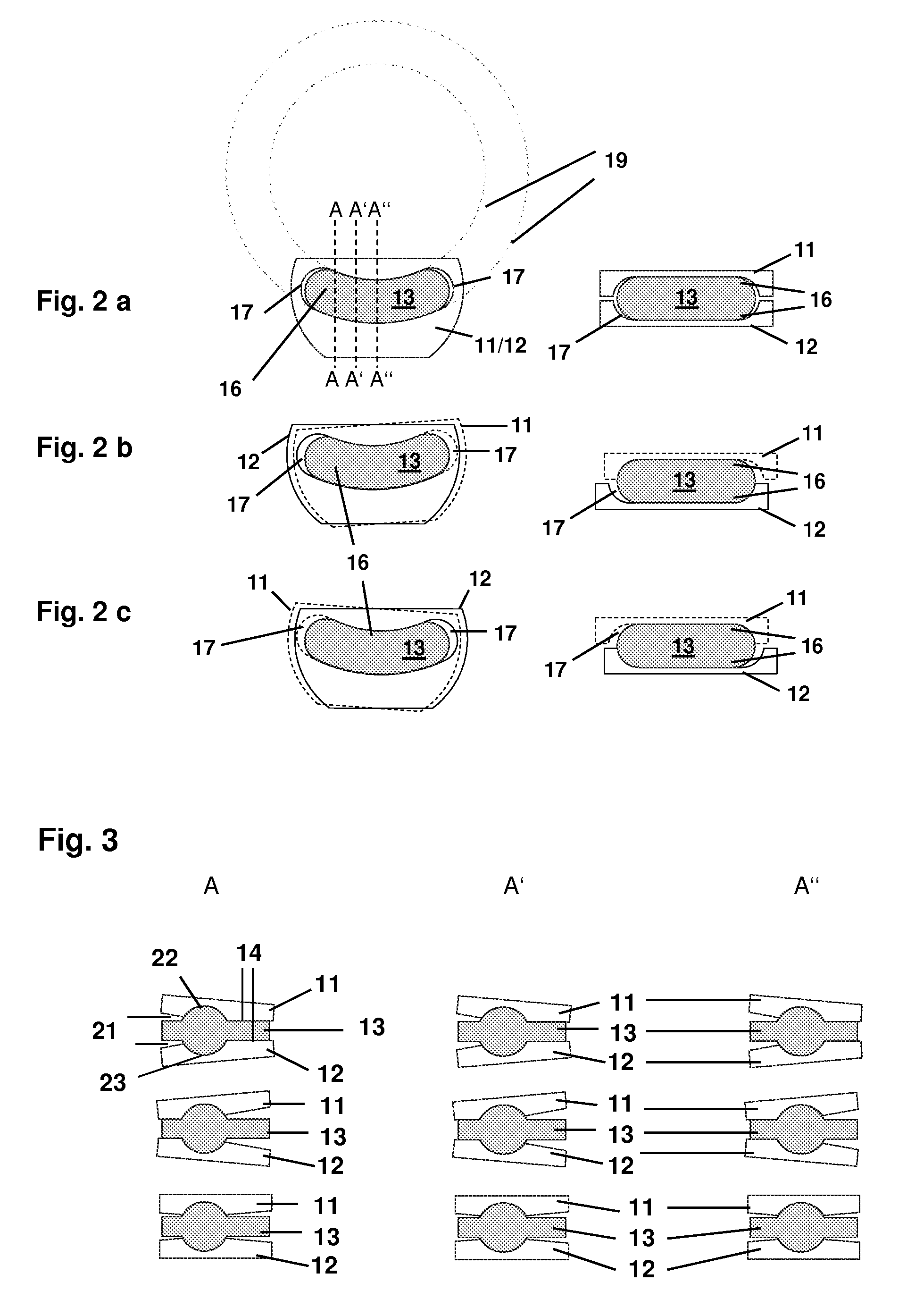 Intervertebral disc prosthesis with transversally arched, curved cylindrical articulation surfaces for the lumbar and cervical spine