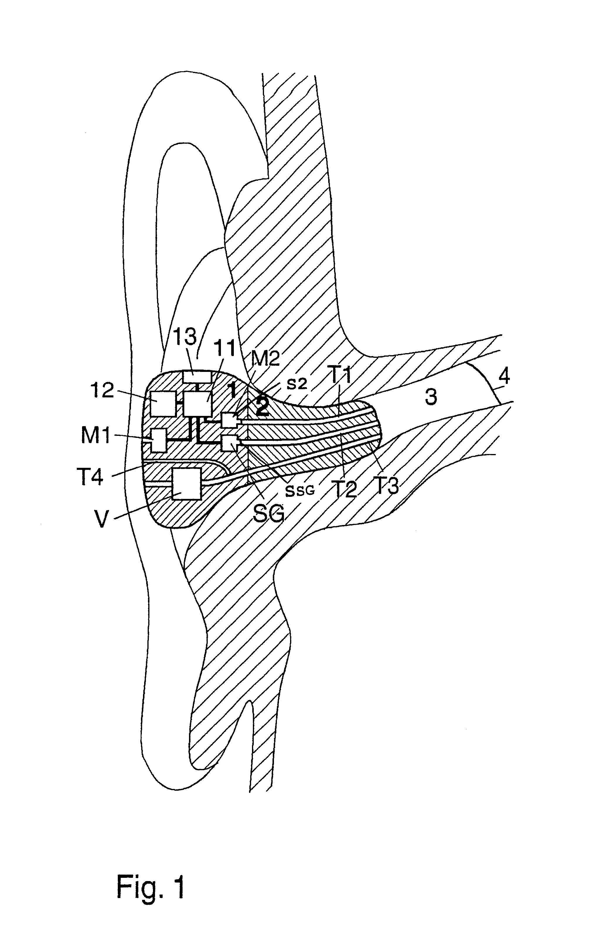 Noise protection verification device