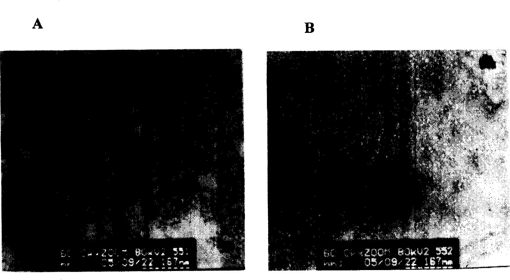 Mosaic type virus-like particle DNA vaccine