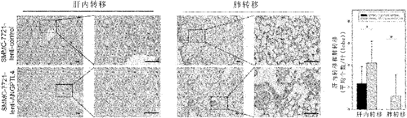 ANGPTL4 as a marker of liver cancer metastasis by serological detection and application thereof