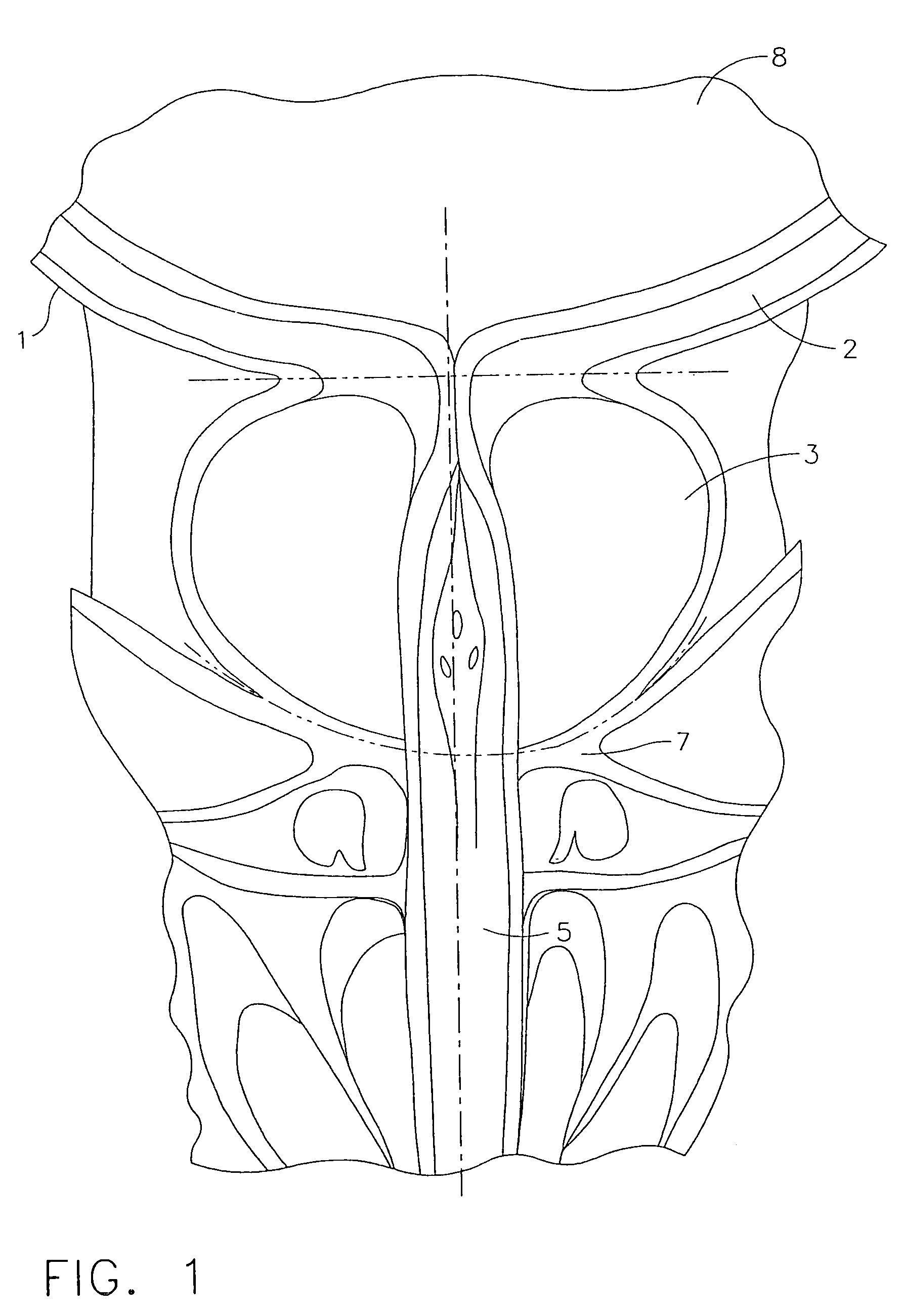 Method and instrument for effecting anastomosis of respective tissues defining two body lumens