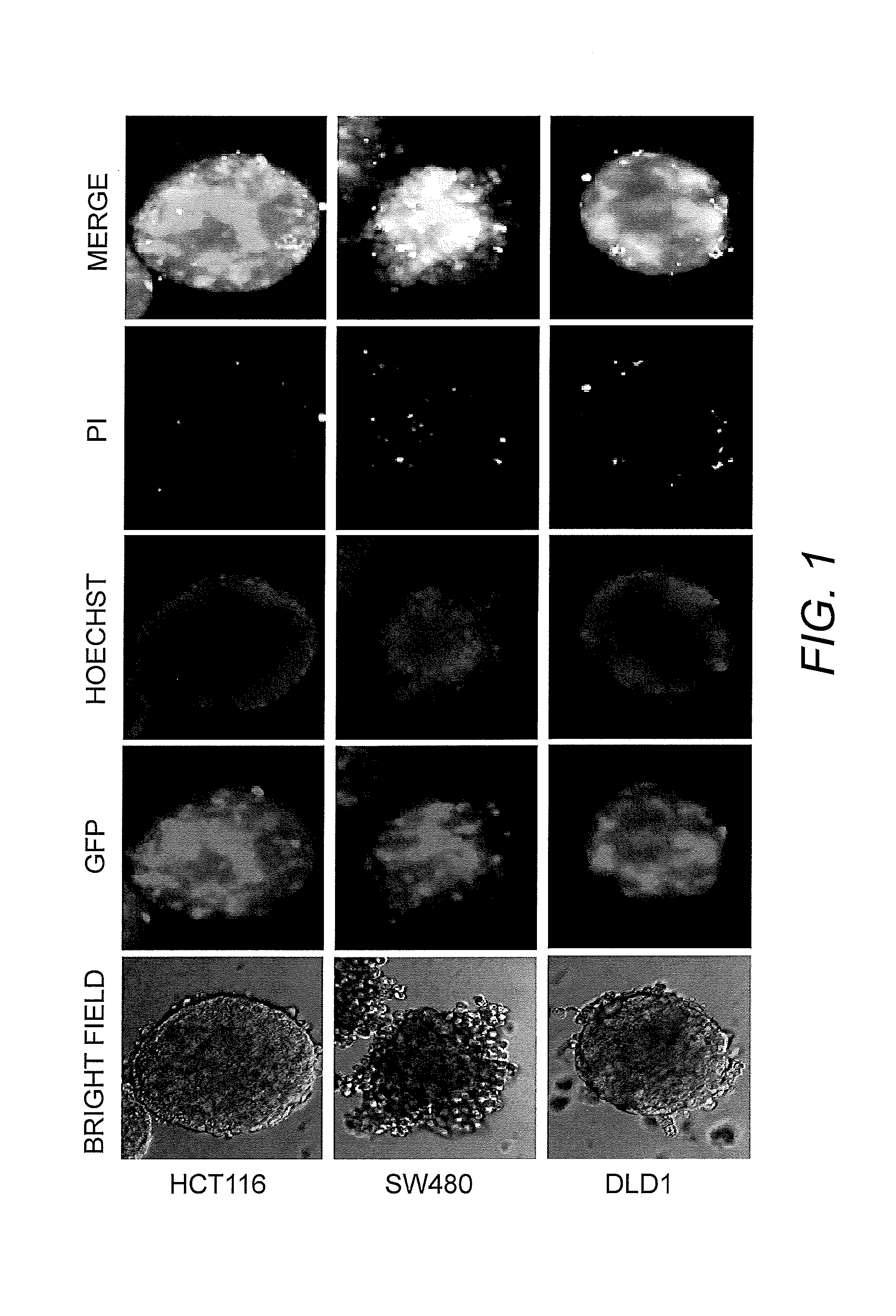 In vitro tumor in dish kit and method