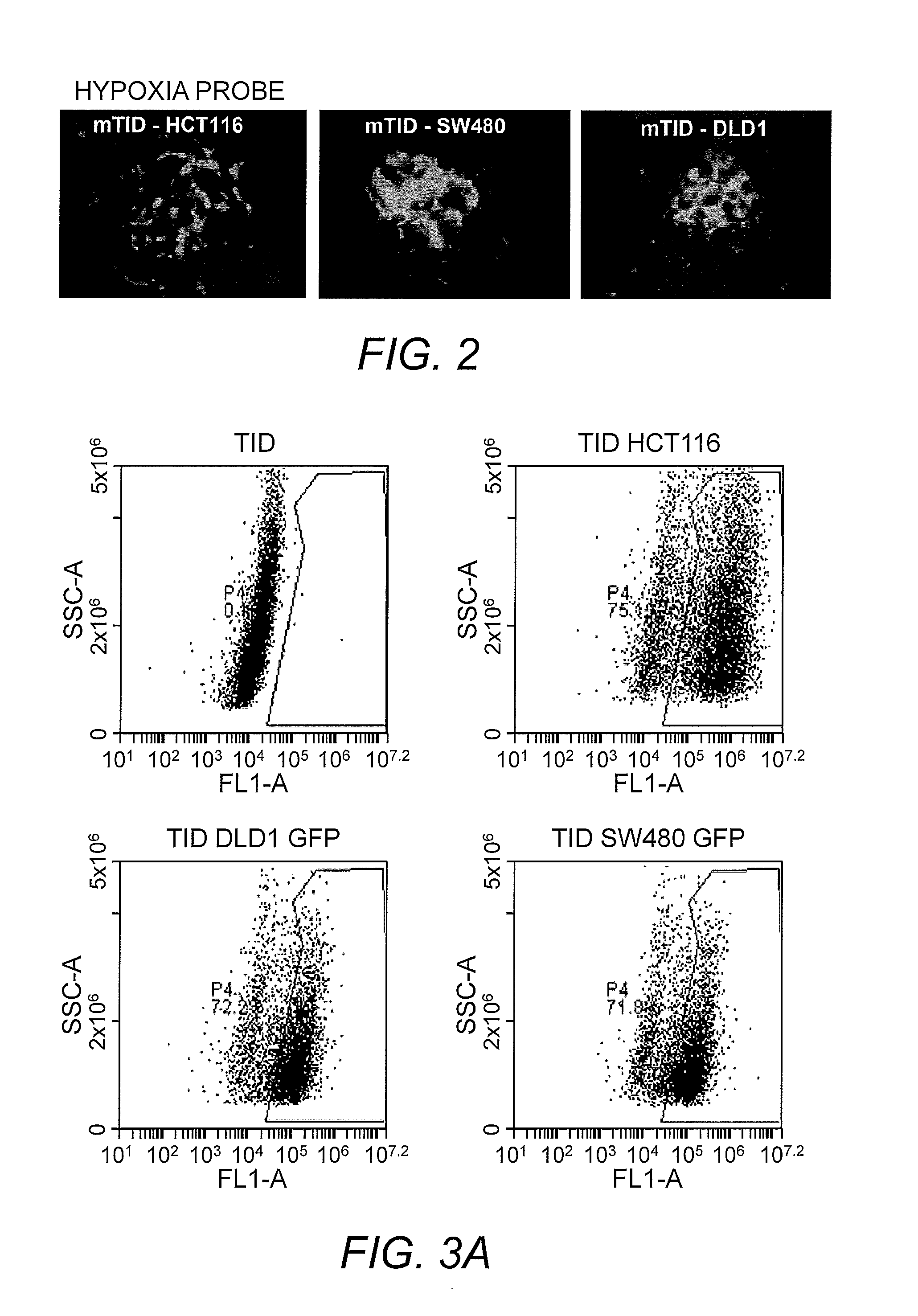 In vitro tumor in dish kit and method