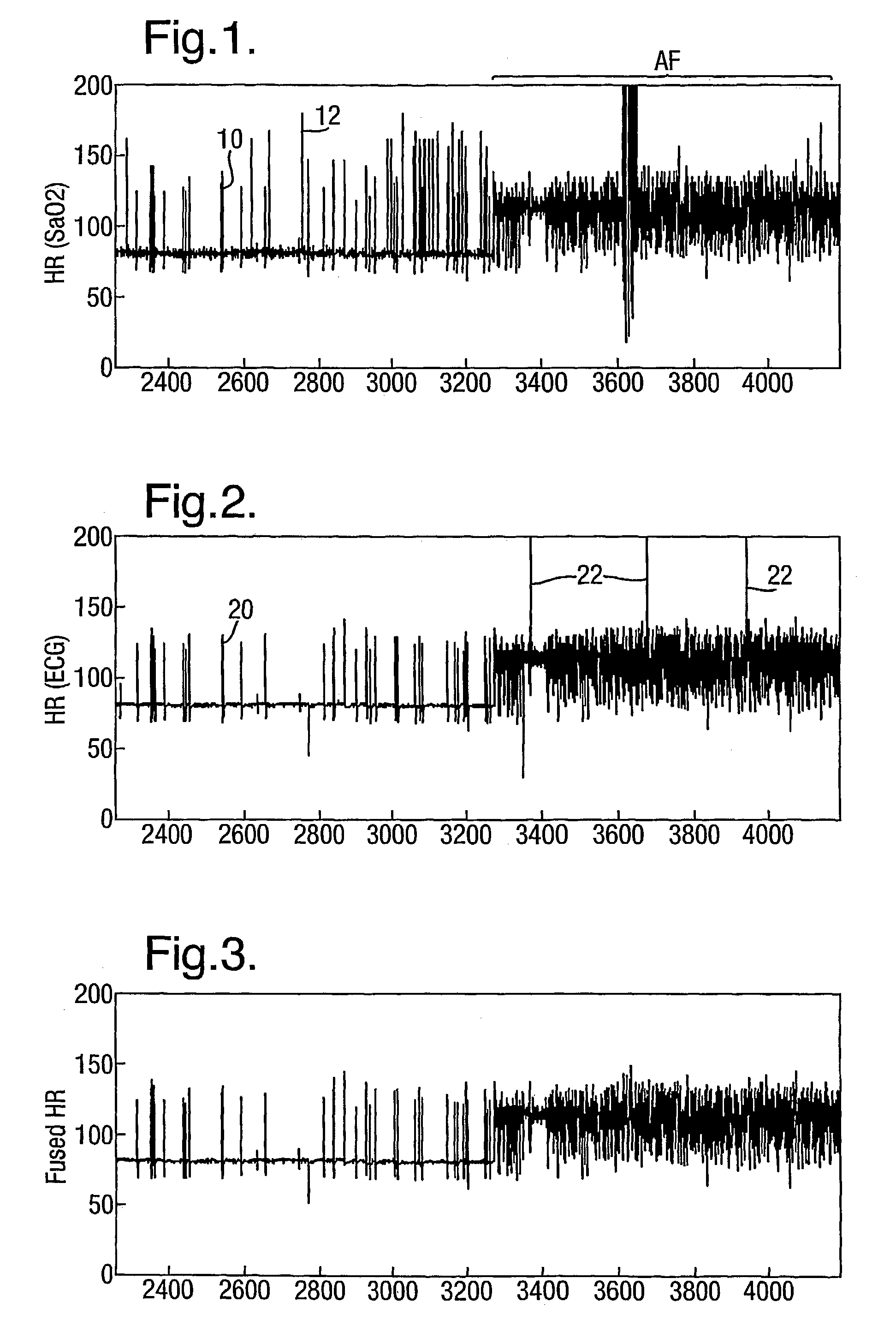 Combining measurements from different sensors