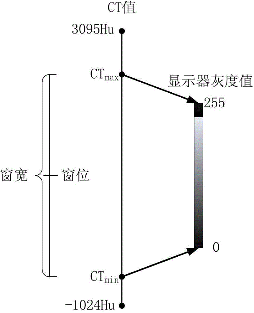 CUDA-based DICOM medical image dynamic nonlinear window modulation method