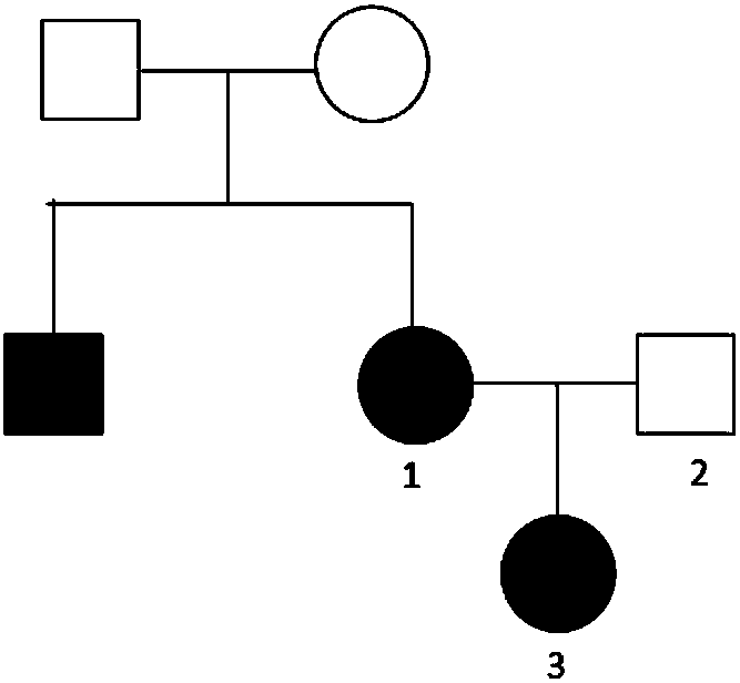 Marker assisting epilepsy diagnosis and detection kit of marker