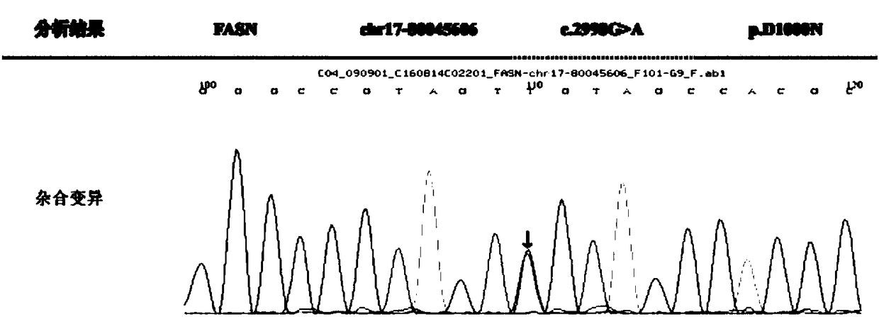 Marker assisting epilepsy diagnosis and detection kit of marker