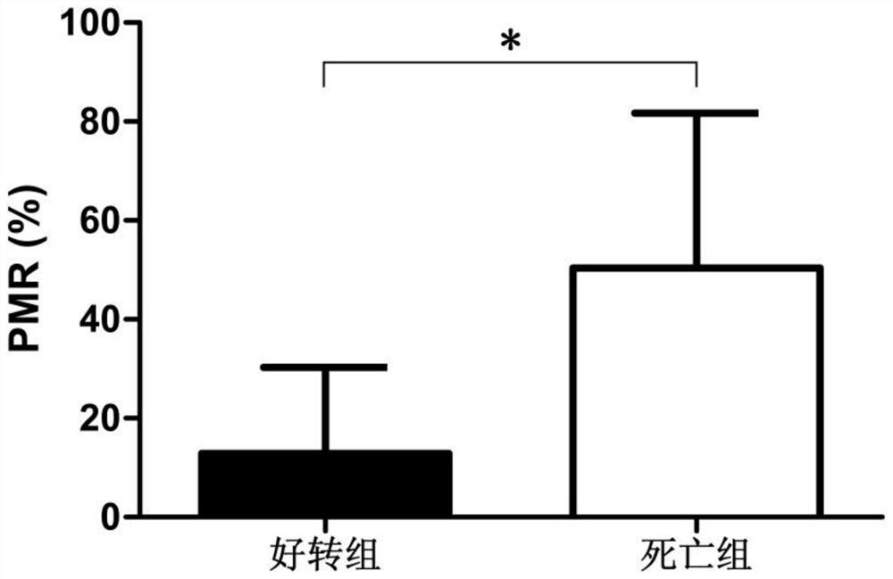 Biomarker for early detection of severe hepatitis B virus as well as detection kit and application thereof