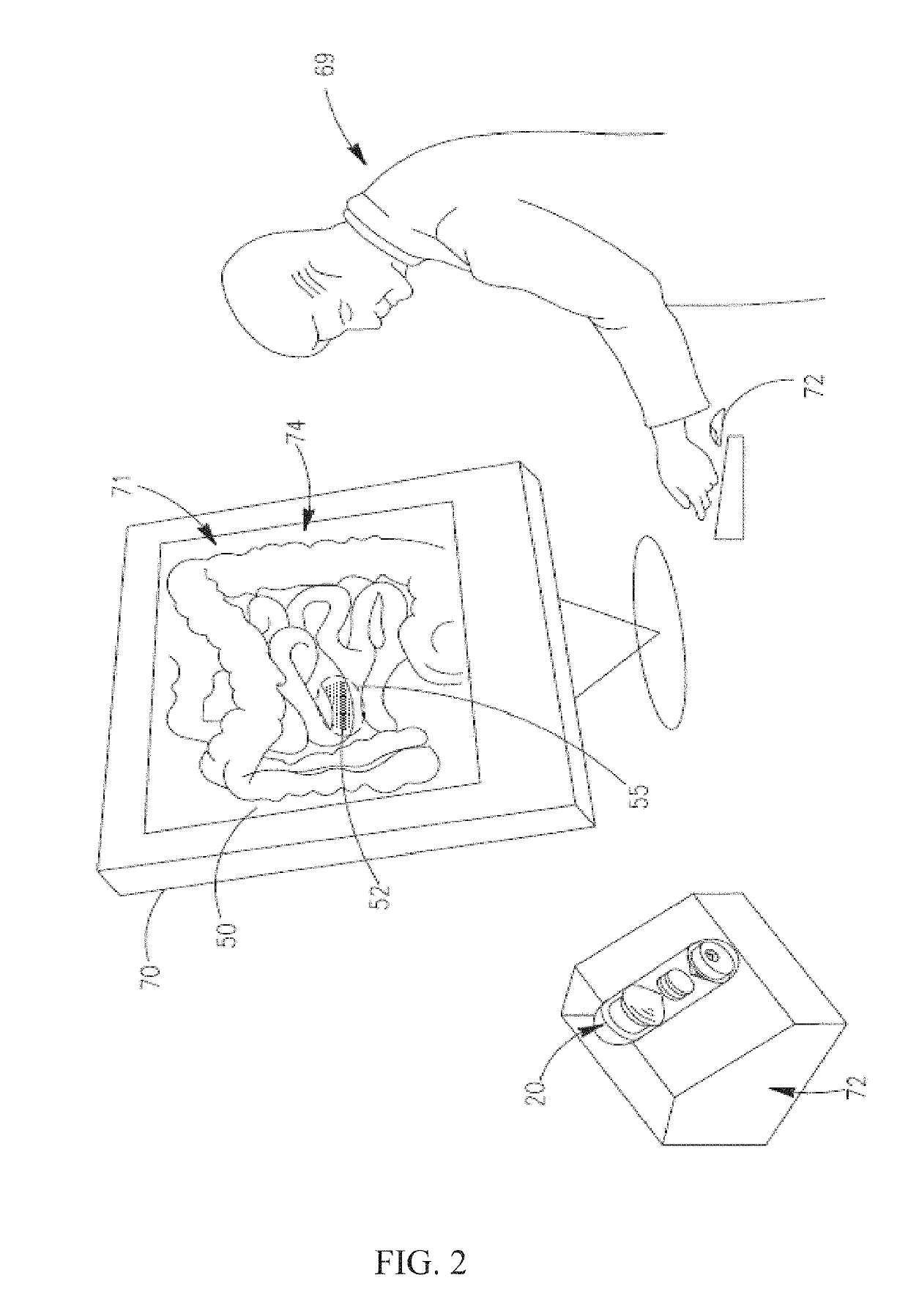 Capsule phototherapy