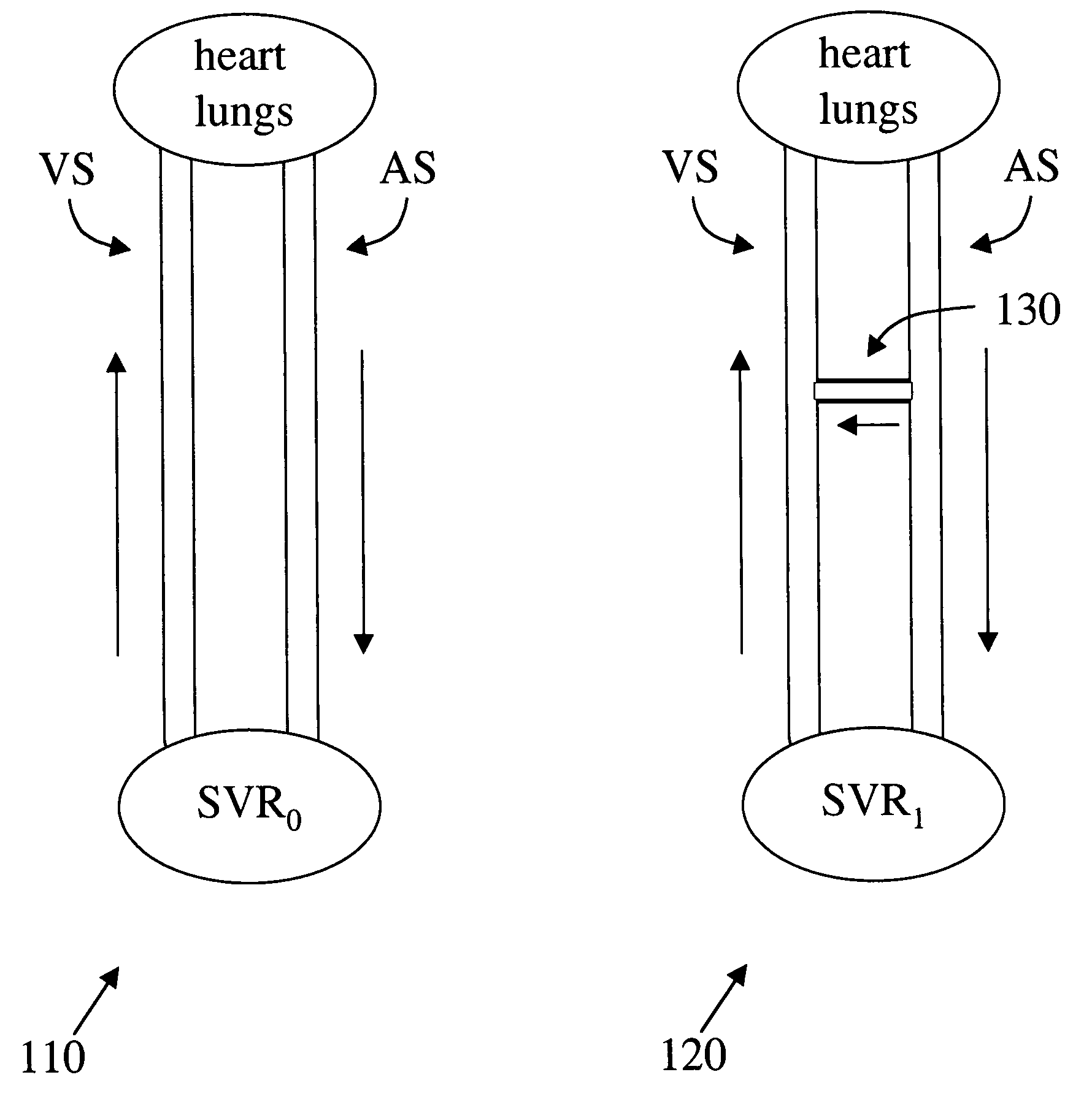 Implantable arterio-venous shunt devices and methods for their use