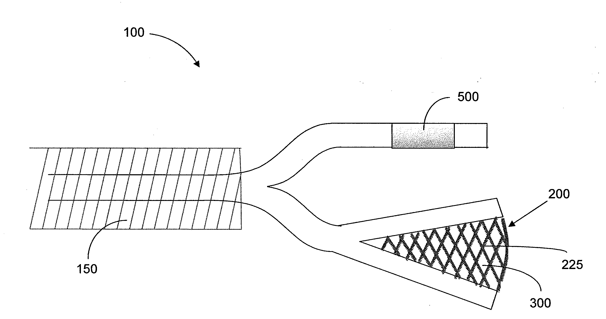 Interventional drug delivery system and associated methods