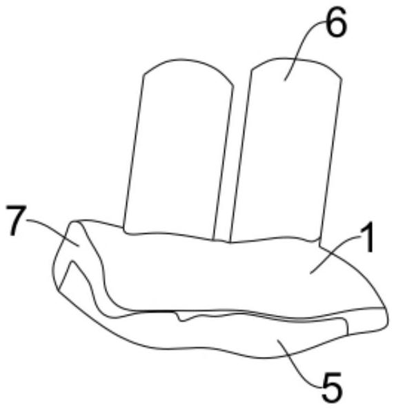 Precise displacement guide plate for Latarjet operation and using method thereof