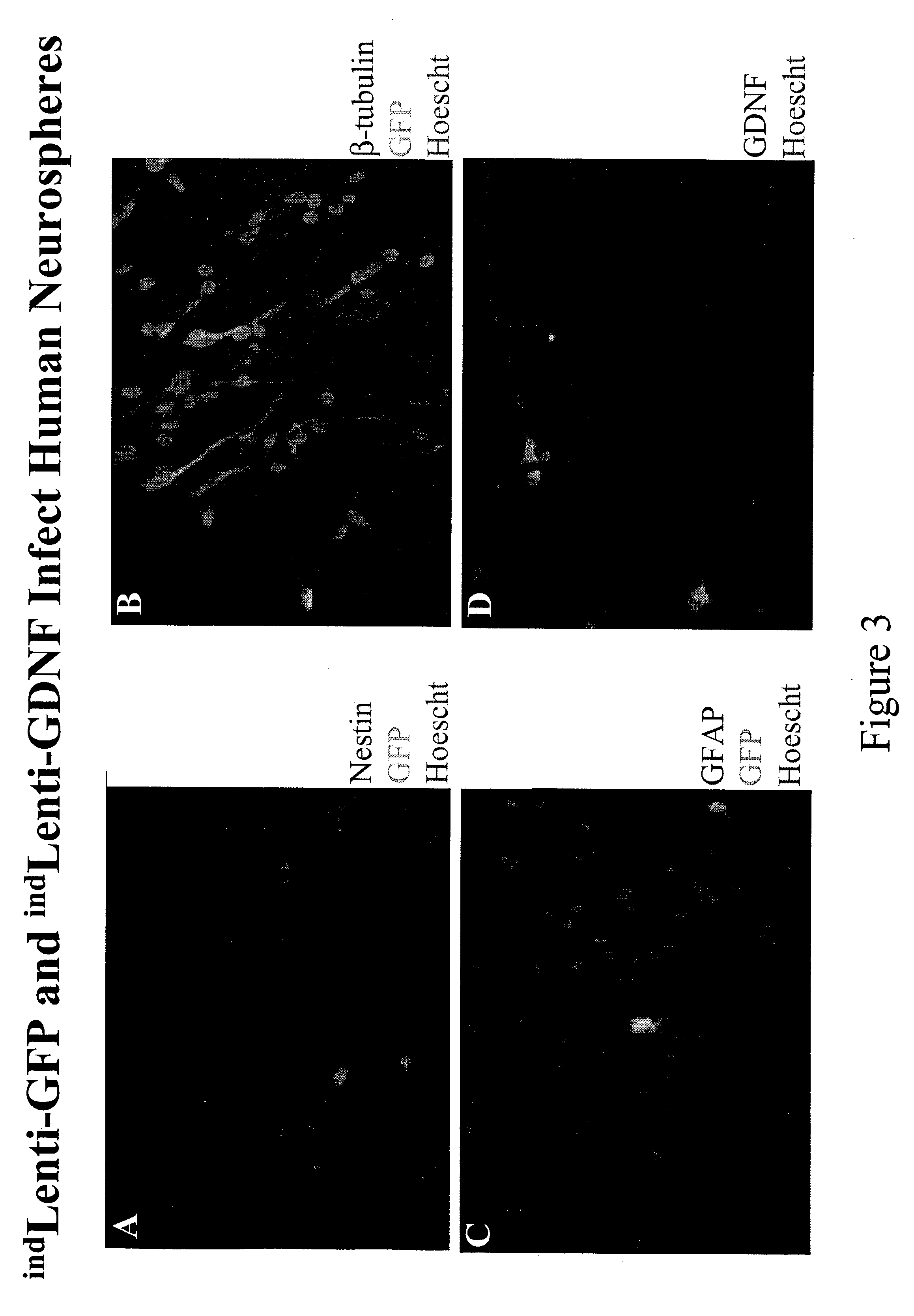 Use of human neural stem cells secreting GDNF for treatment of parkinson's and other neurodegenerative diseases