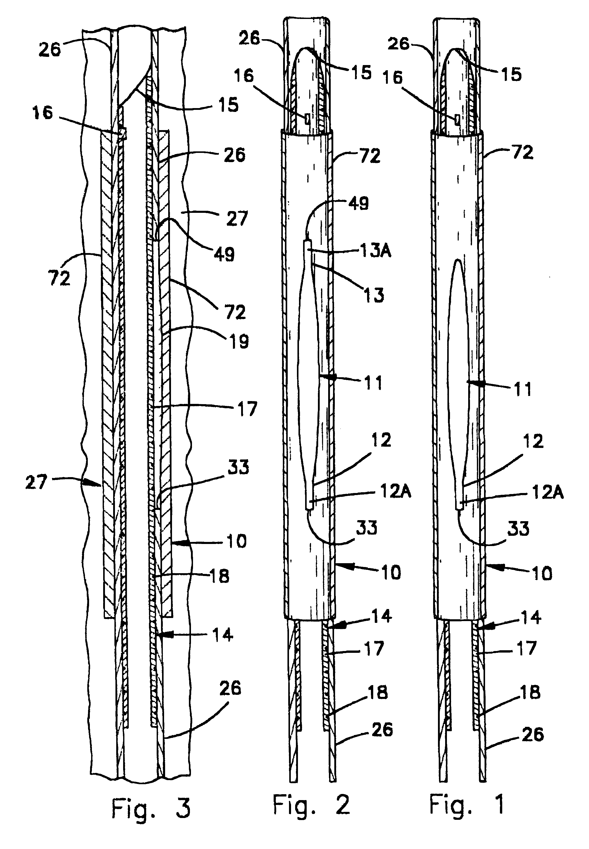 Assembly and method for providing a means of support and positioning for drilling multi-lateral wells and for reentry therein through a premilled window