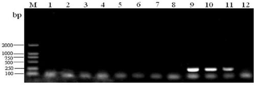 Rapid qualitative and quantitative detection kit, detection method and application of Lactobacillus acidophilus added in feed