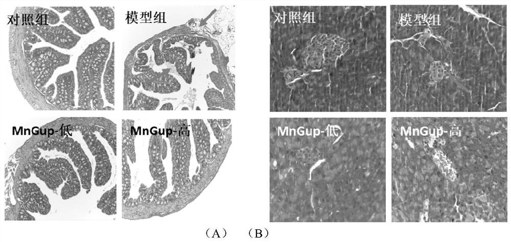 Bifidobacterium lactis MN-Gup and application of microbial inoculum thereof in treatment of type 2 diabetes mellitus