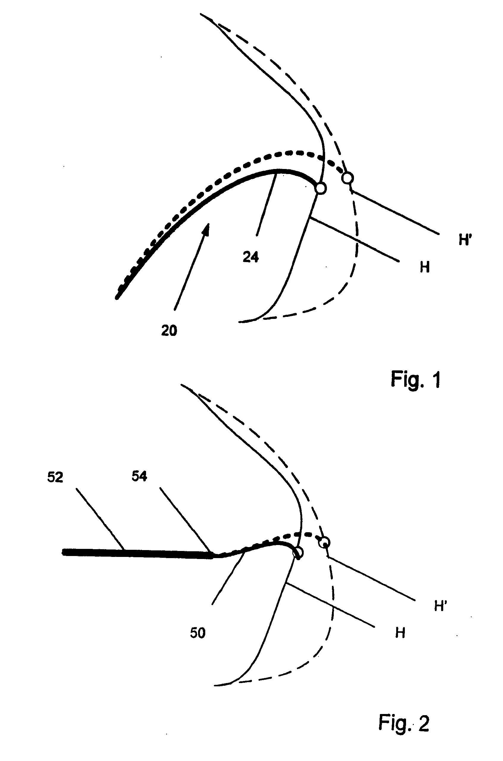 Electrophysiology catheter and system for gentle and firm wall contact