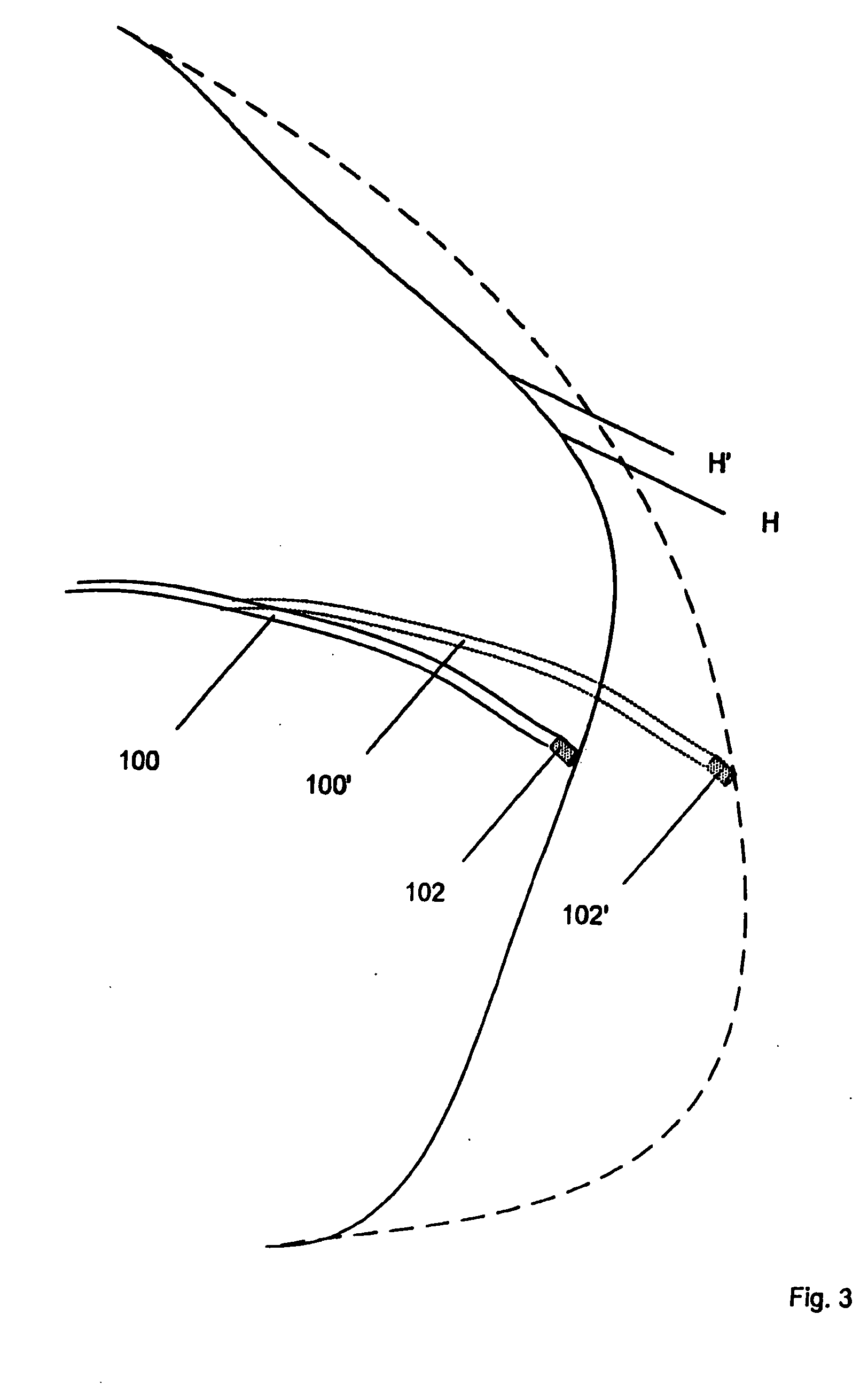 Electrophysiology catheter and system for gentle and firm wall contact