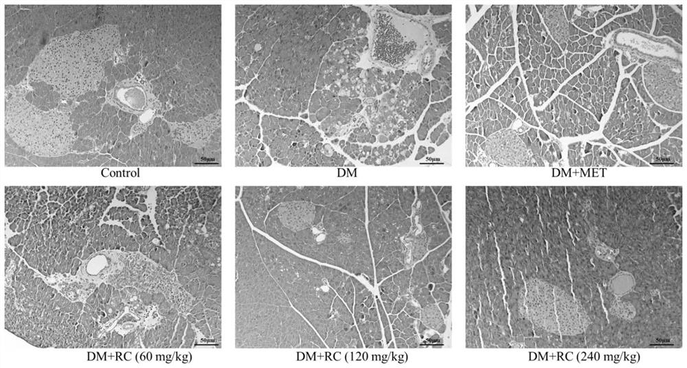 Application of rhaponticum aestivum alcohol extract in treatment and/or prevention of diabetes mellitus