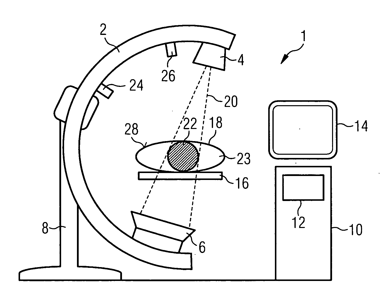 Method for minimizing image artifacts and medical imaging system