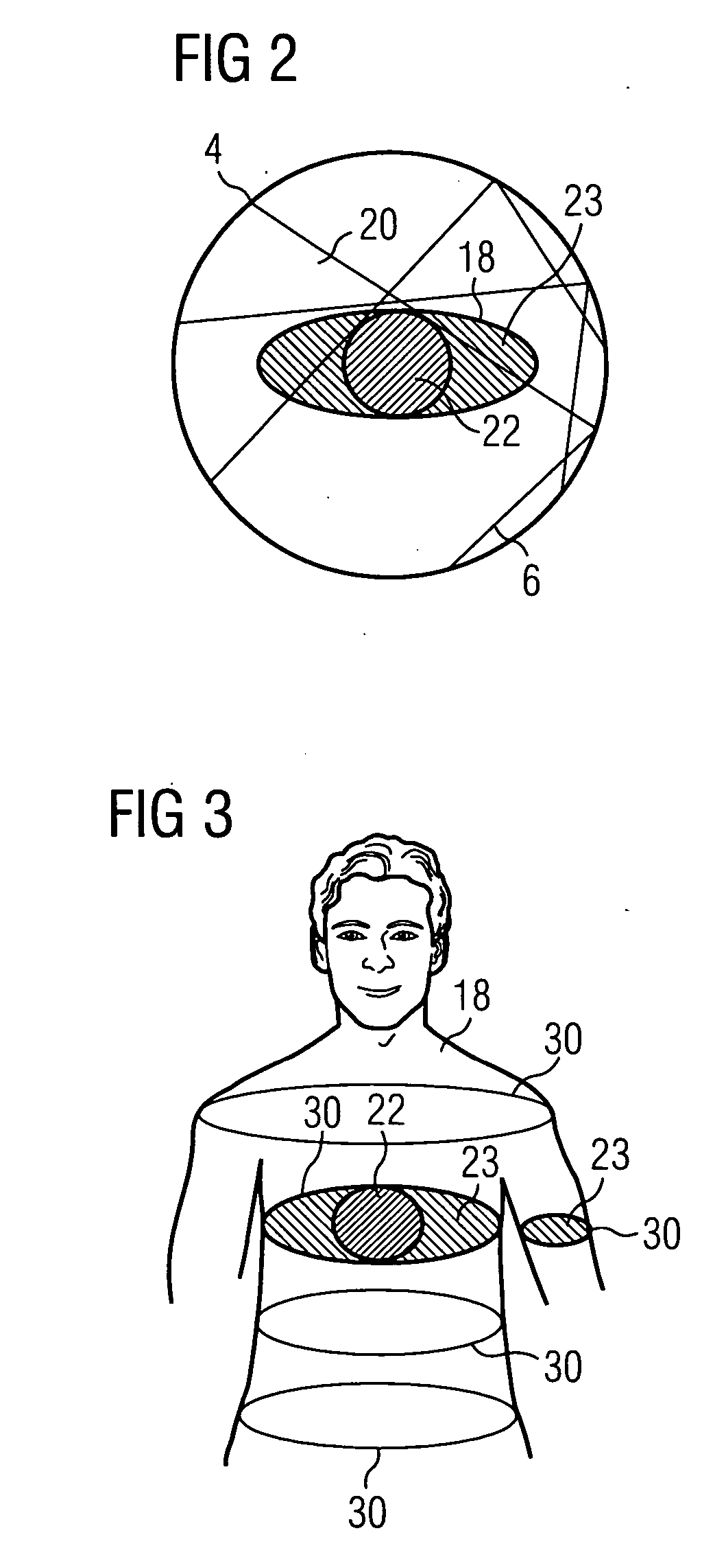 Method for minimizing image artifacts and medical imaging system