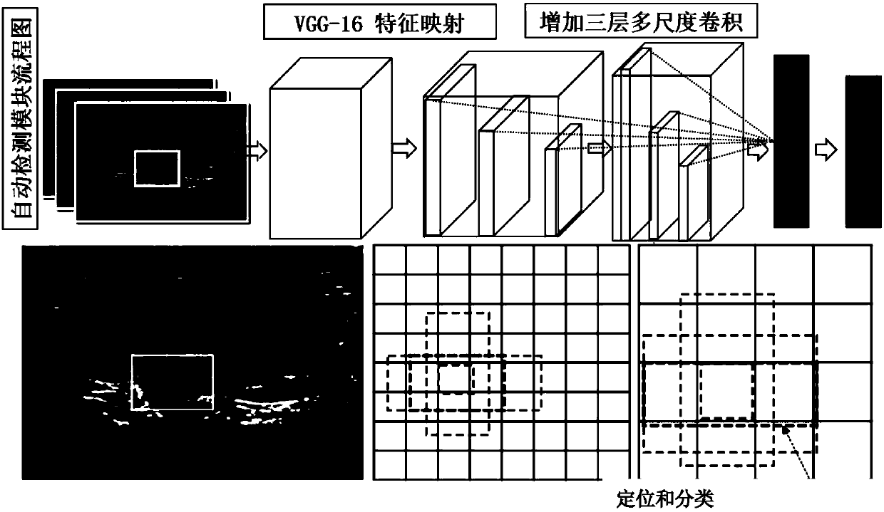 Thyroid ultrasound image nodule automatic diagnosis system based on multi-scale convolutional neural network