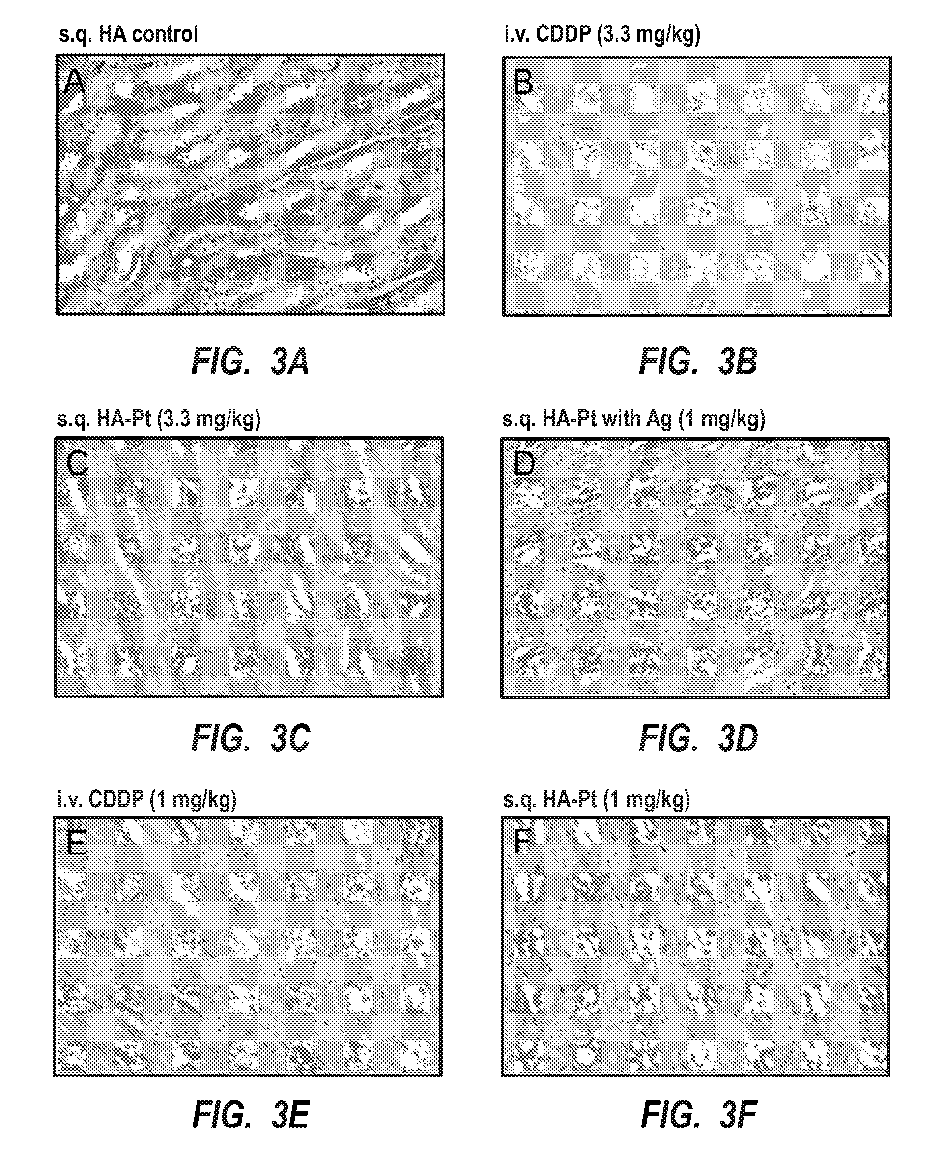 Intralymphatic chemotherapy drug carriers