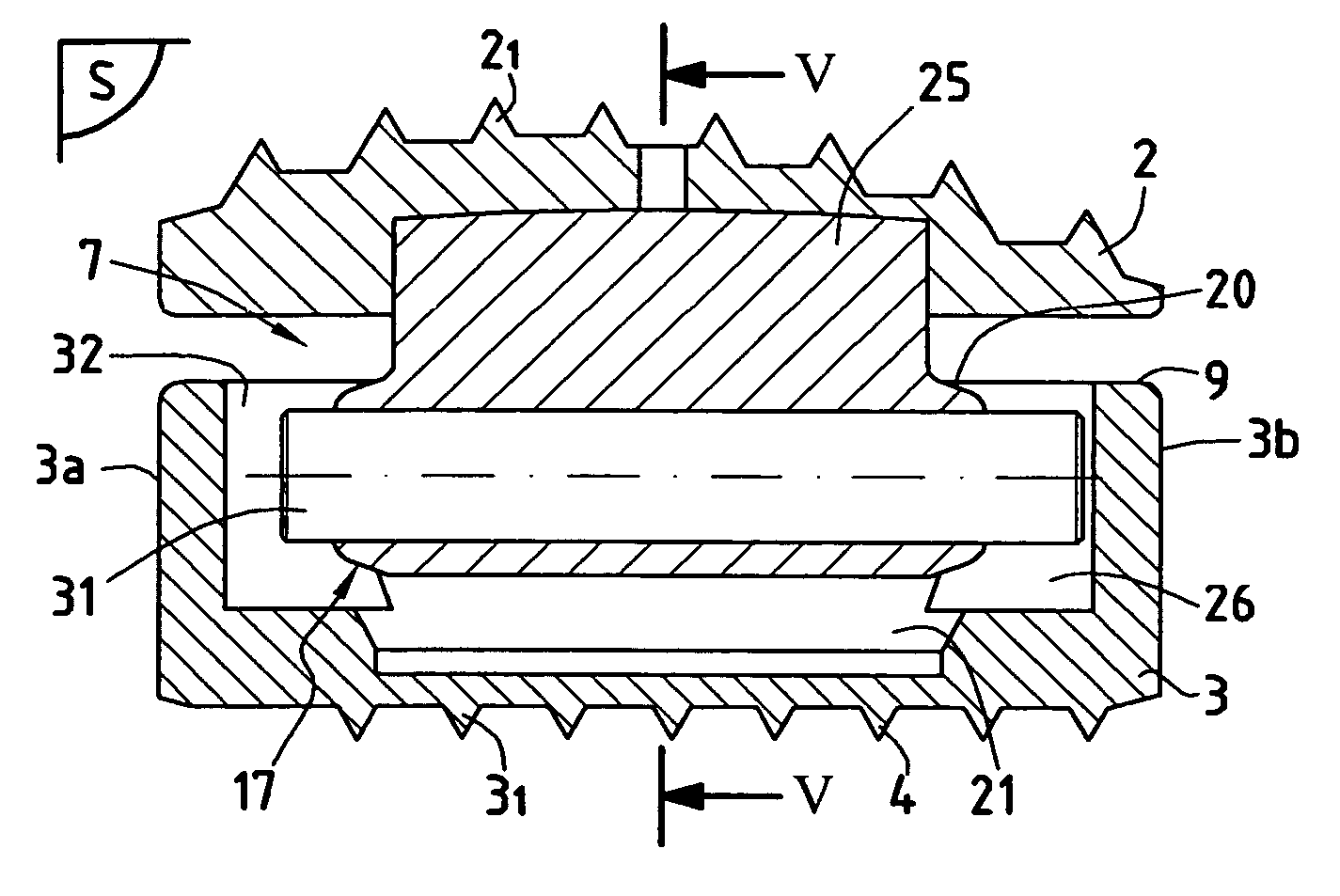 Disk prosthesis for cervical vertebrae with controlled clearance