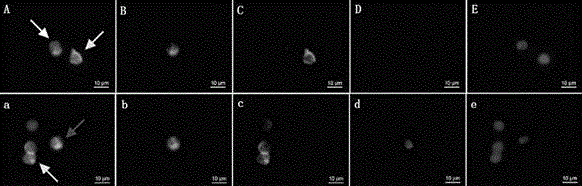 Circulating tumor cell detection kit and application thereof