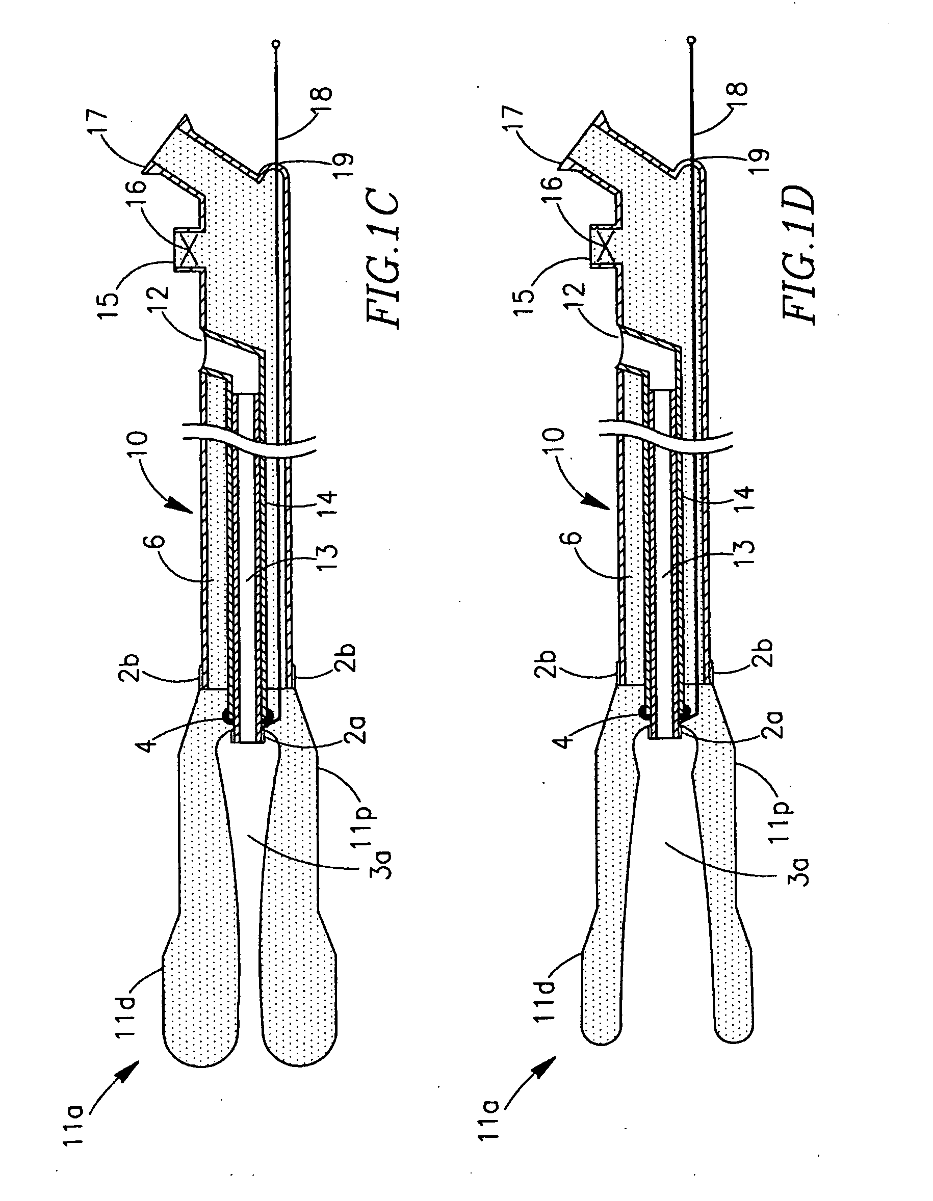 Intussuscepting balloon catheter and methods for constructing and using thereof