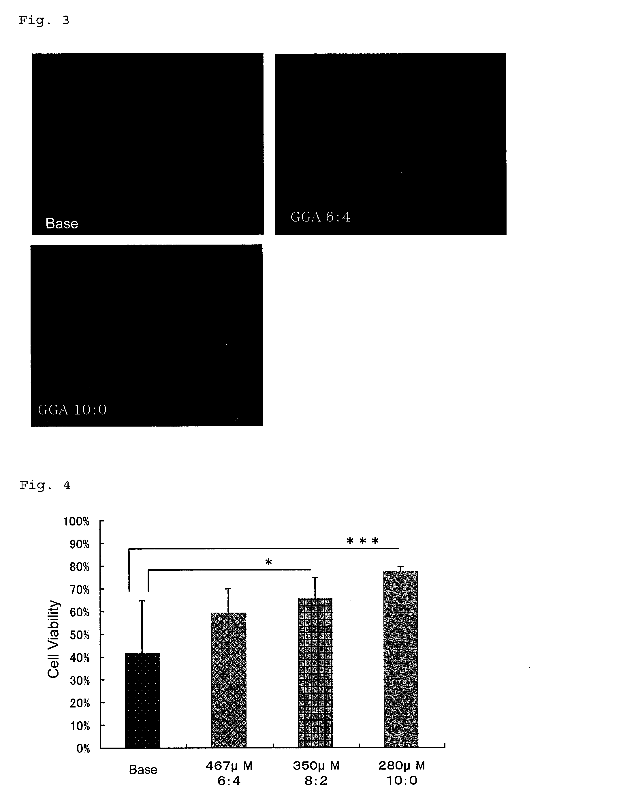 Ophthalmic composition comprising geranylgeranylacetone