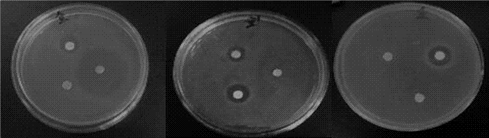 Citrus mitis essential oil with bacteria-inhibiting activity and preparation method and application thereof