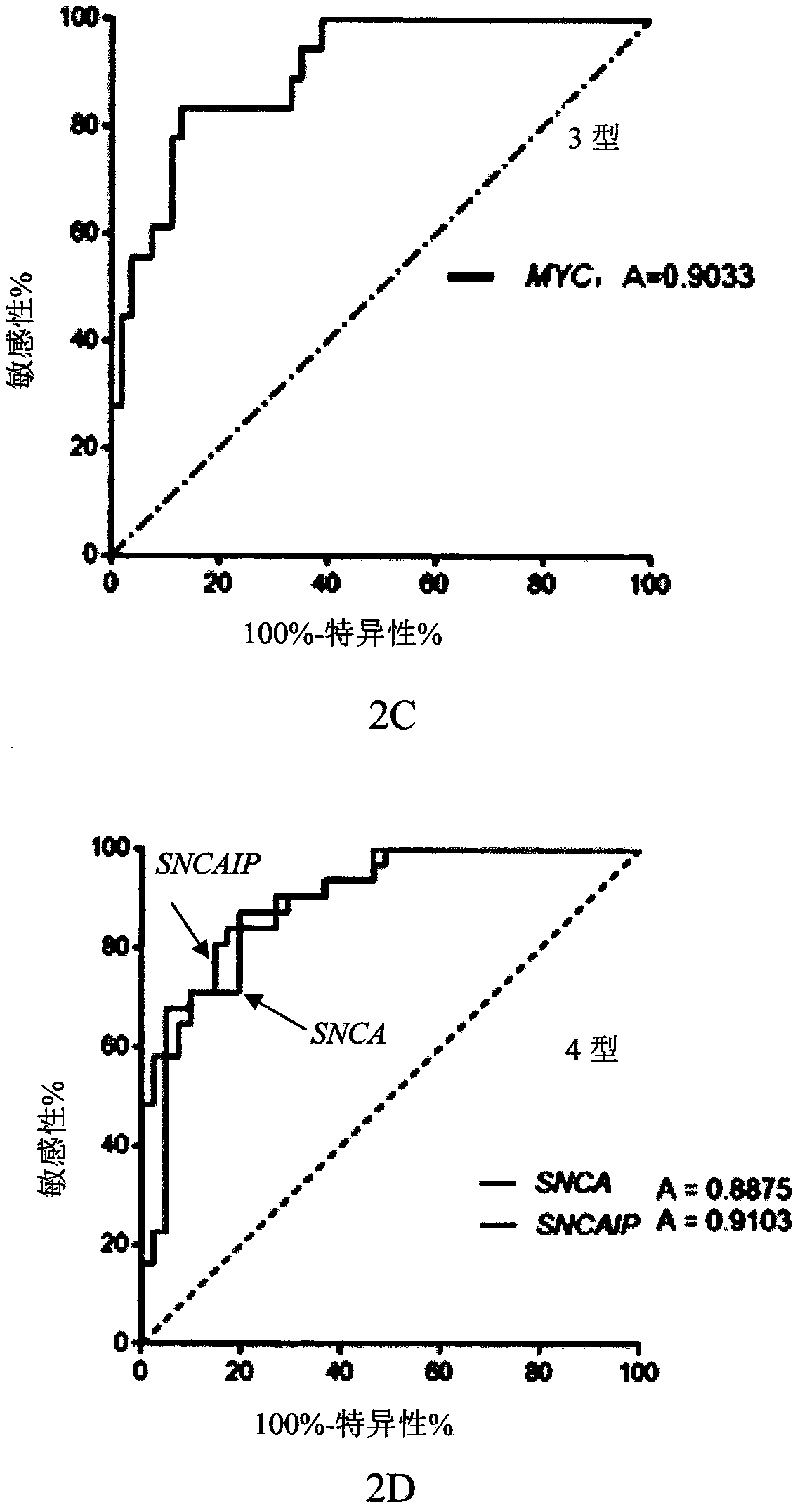 Genetic group for molecular subtyping of medulloblastoma and use of SNCA gene as biomarker of 4-type medulloblastoma