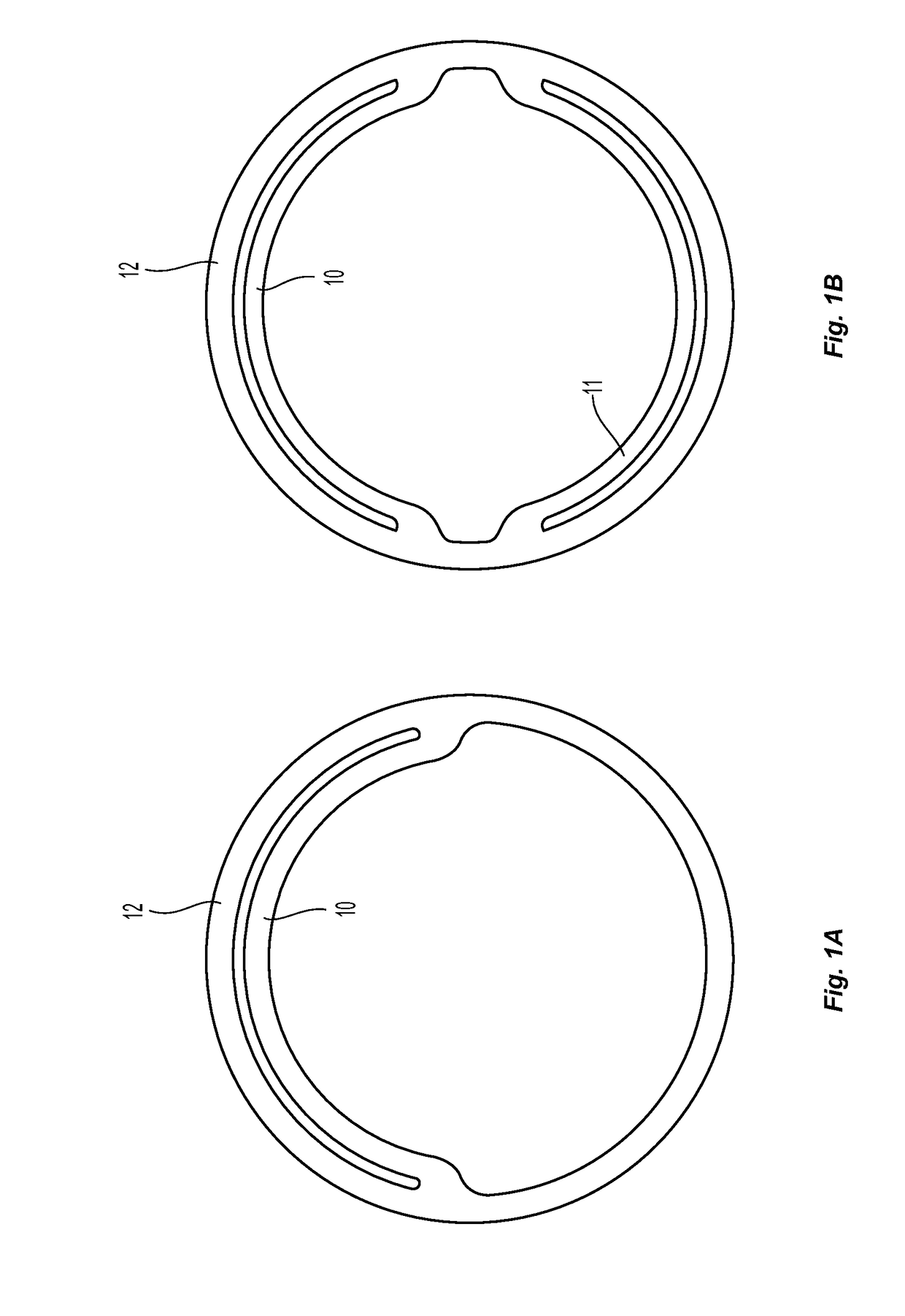 Systems and methods for endoluminal valve creation