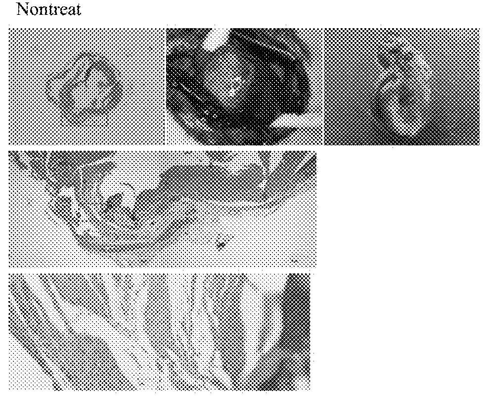 Hybrid gel comprising particulate decellularized tissue