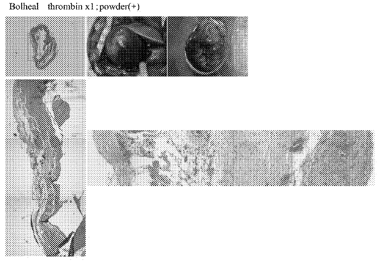 Hybrid gel comprising particulate decellularized tissue