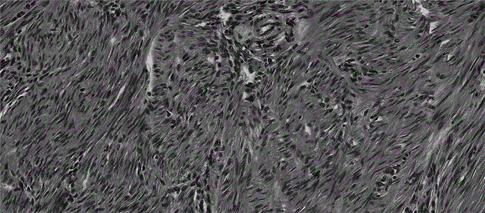 Hematoxylin-eosin one-step dyeing method