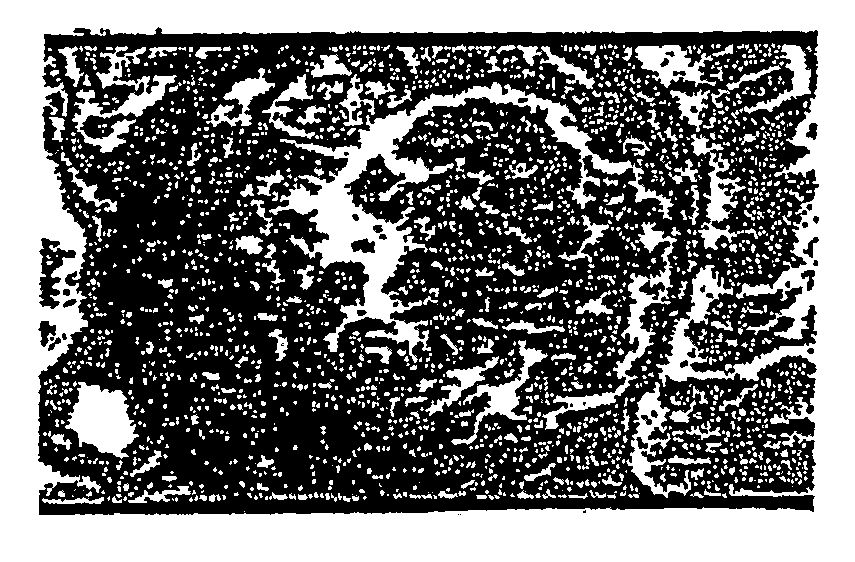 Compositions and Methods Related to Fructosamine-3-Kinase Inhibitors