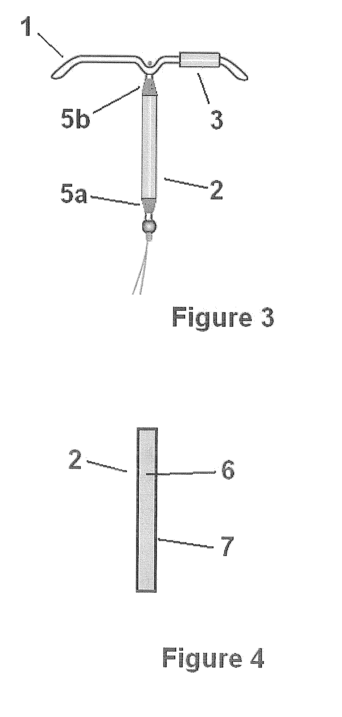 Intrauterine delivery system for contraception