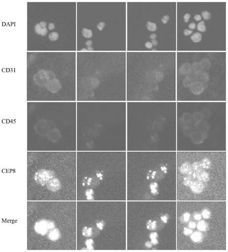 Preparation method of separation tube for separating tumor cells