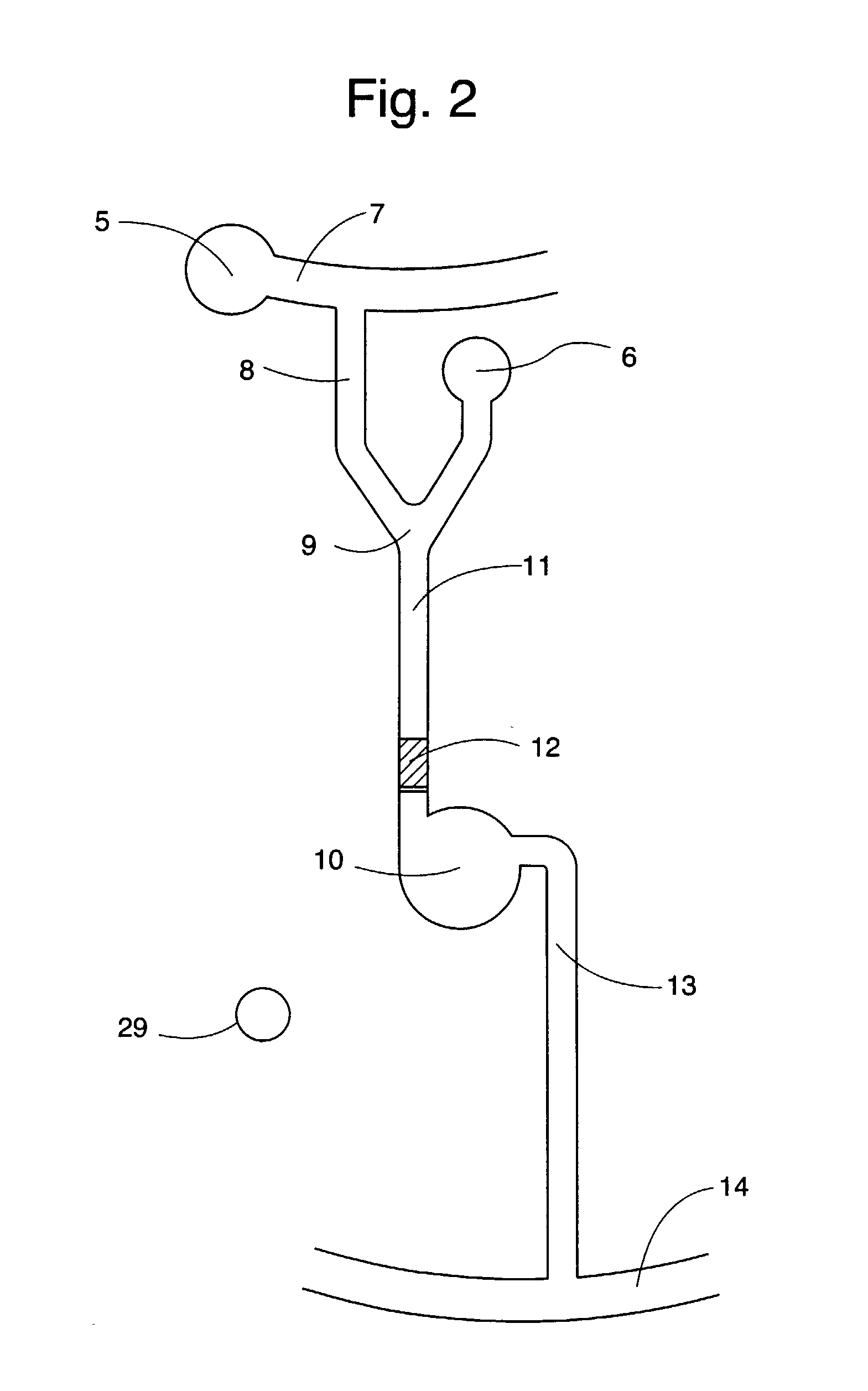 Microfluidic system (mdi)