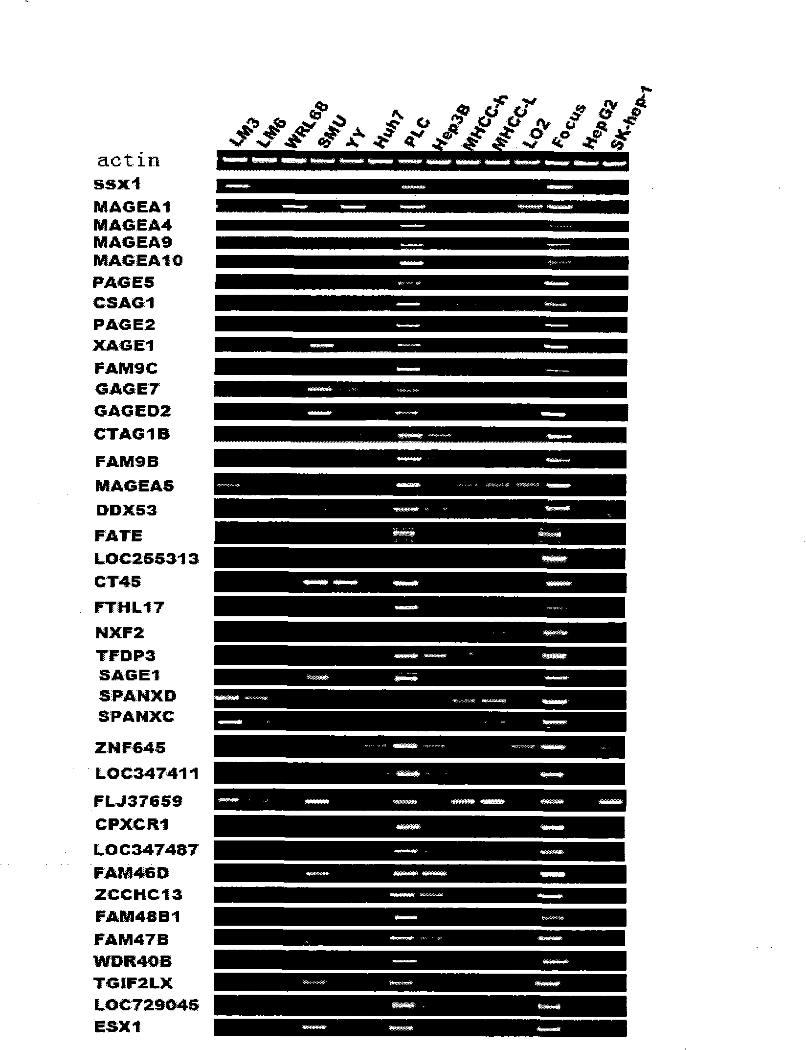 Uses of MAGEA4 gene