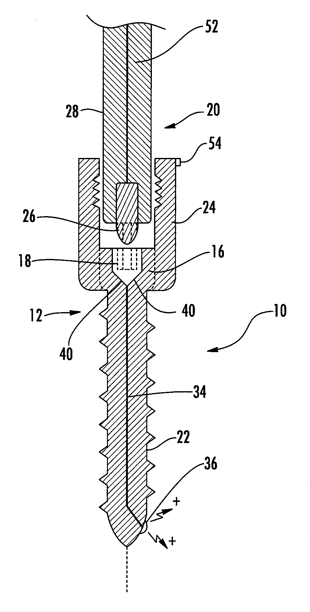 Implant equipped for nerve location and method of use