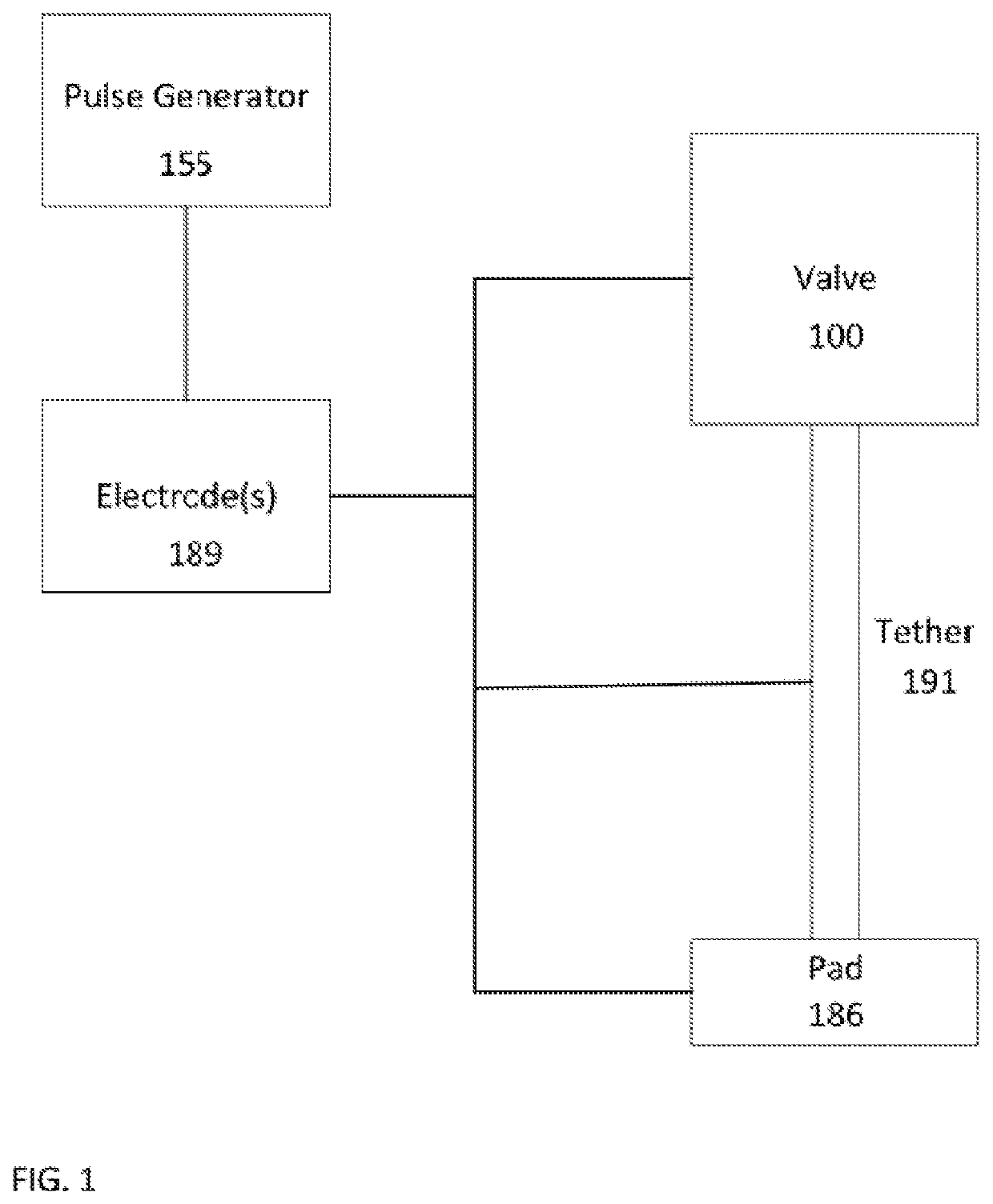 Prosthetic Heart Valve And Methods For Cardiac Hemodynamic Optimization And Monitoring