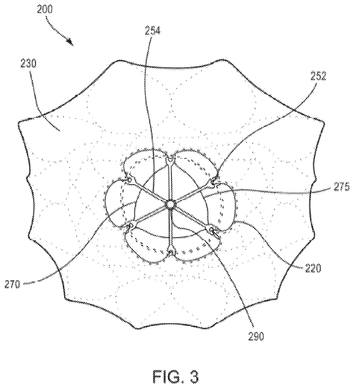 Prosthetic Heart Valve And Methods For Cardiac Hemodynamic Optimization And Monitoring