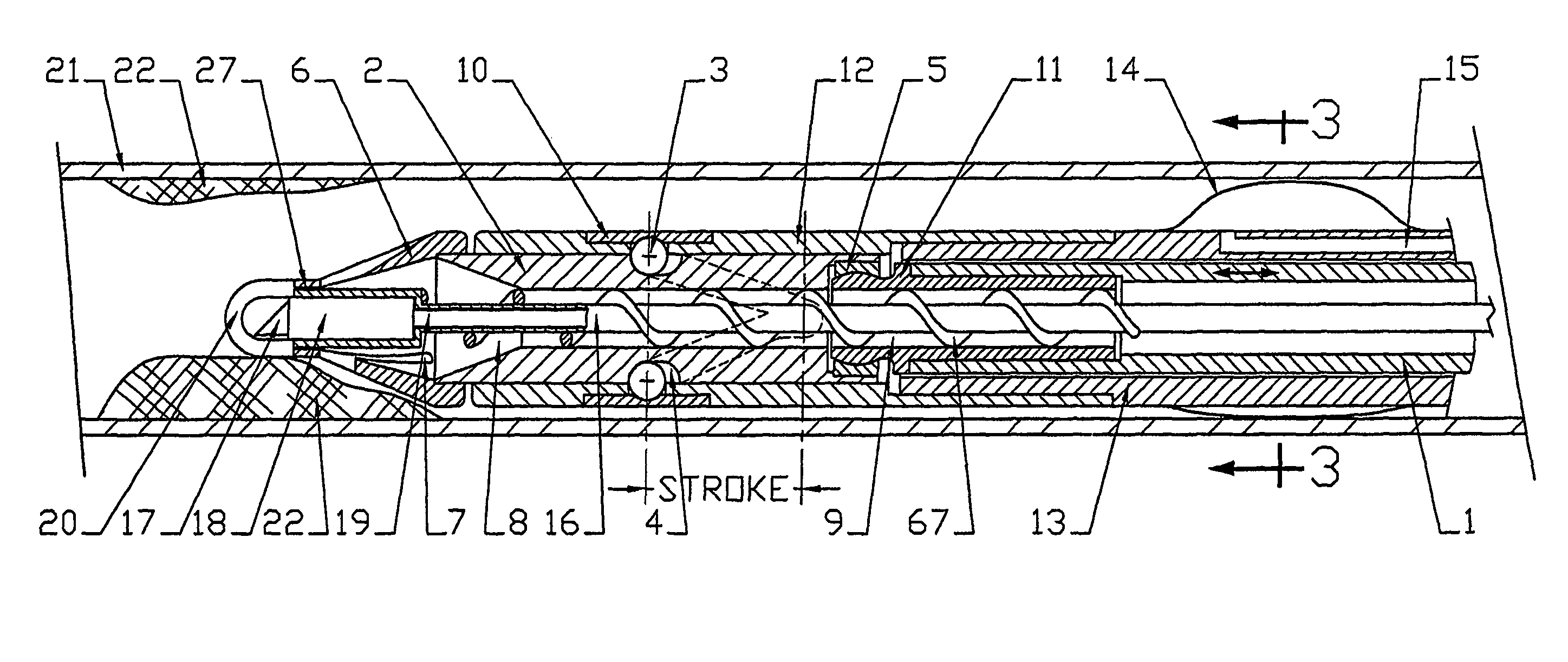 Atherectomy system with imaging guidewire